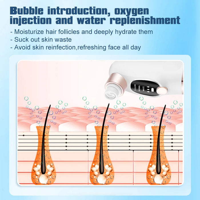 Rechargeable Blackhead Remover